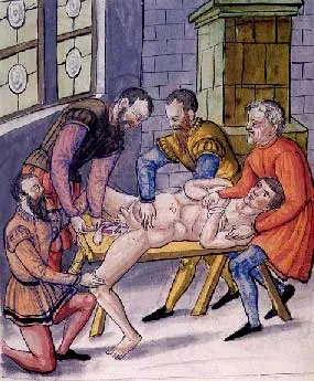 Castrado.jpg