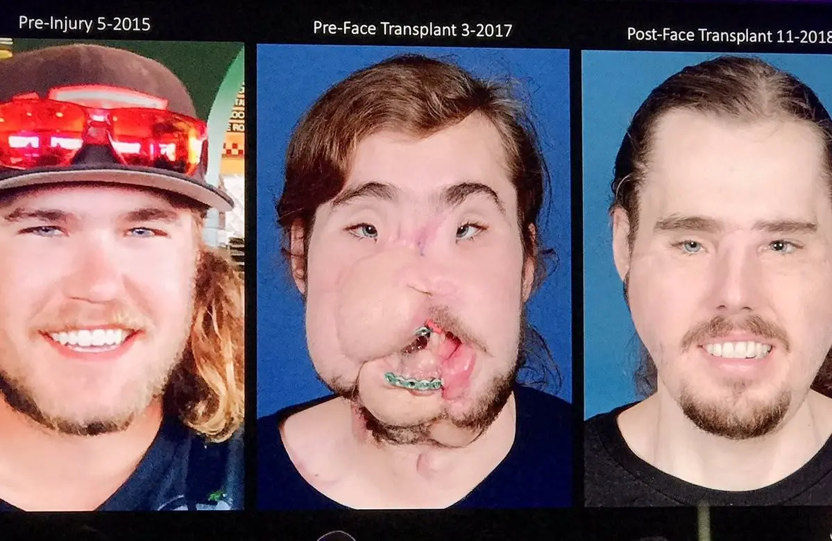 o3eGxhS.jpg