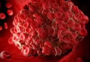 blood-clot-300x207.jpg