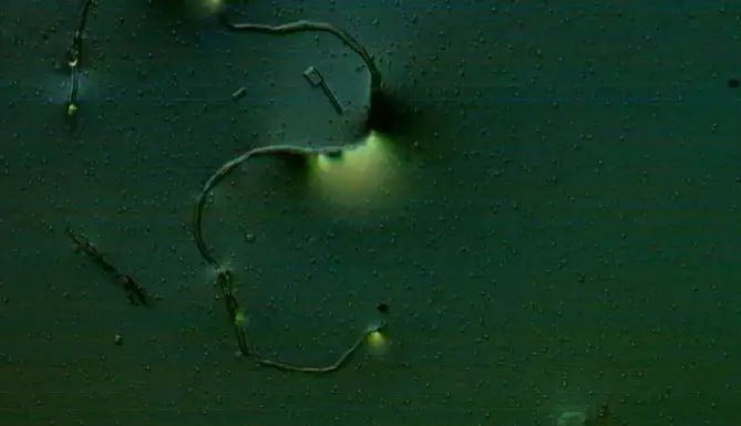 Analisis-morgellons.jpg