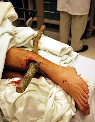 bike+accident.jpg