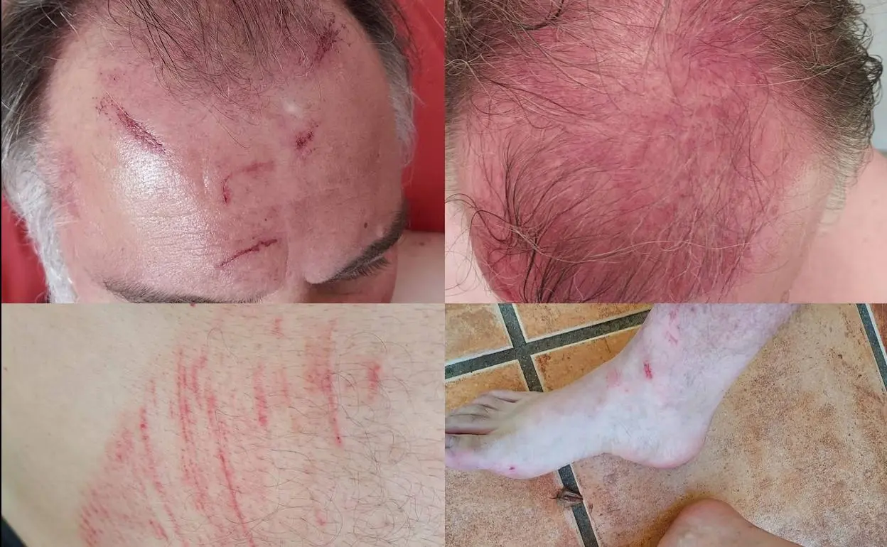 roquetas-agresion-k-Cj-F-U150359038397-Ap-1248x770-Ideal.jpg