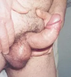 pene%2Bcurvo.jpg