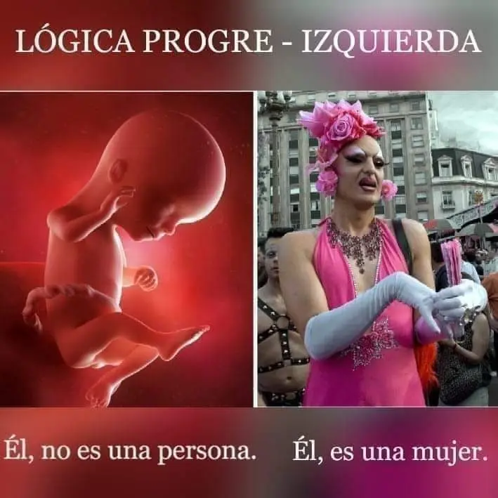 GBzg8bh.jpg
