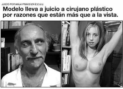bizca.jpg
