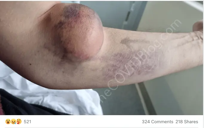 Mark-Ruston-clot.png
