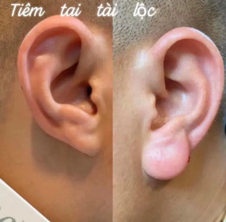 Buddha-ear-lobes-750x736.jpg