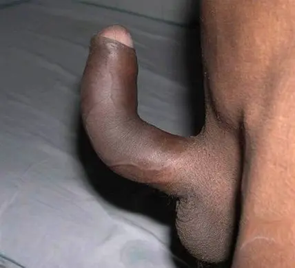 r-pene.jpeg